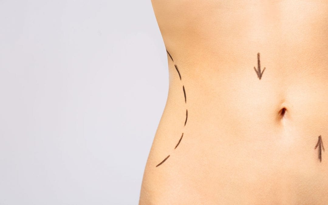 Is body contouring surgery available only to women?